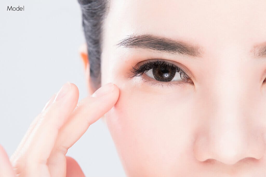 Asian Blepharoplasty