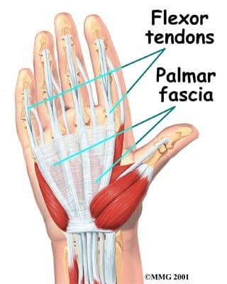 Flexor Tendon Laceration