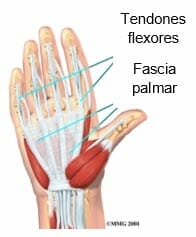 Laceración del tendón flexor