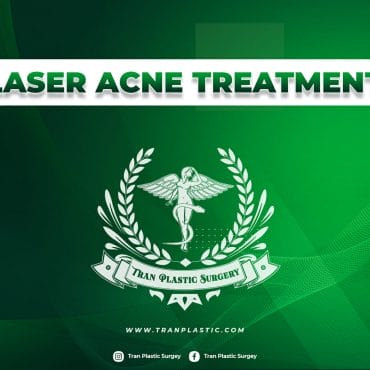 Discover the power of laser acne treatment