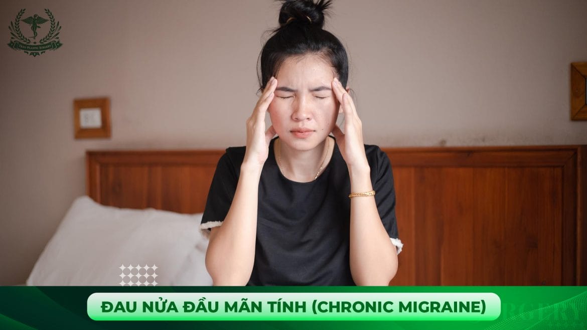 Đau nửa đầu mãn tính (Chronic Migraine)