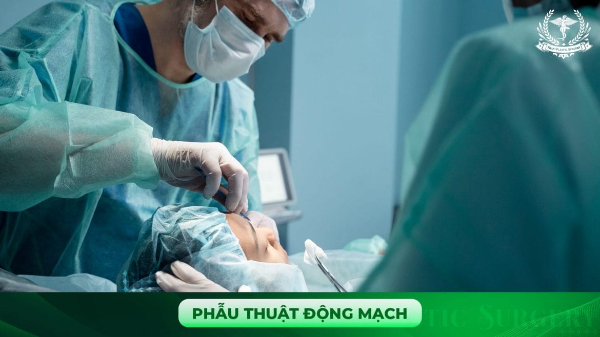 Phẫu thuật động mạch