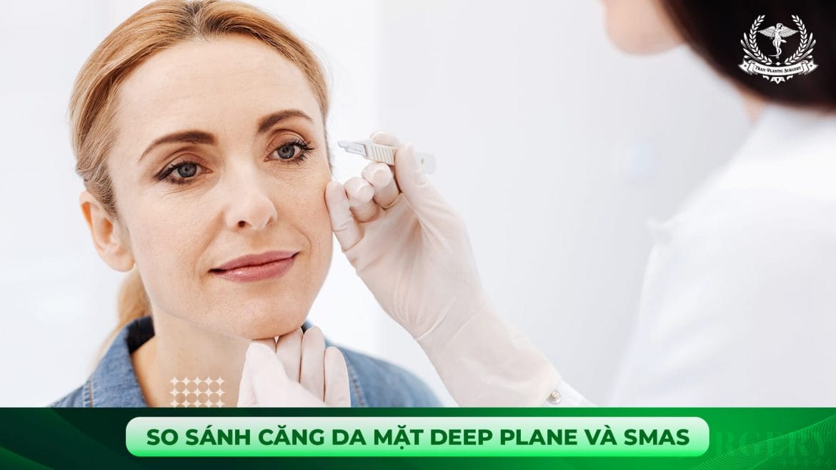 So sánh căng da mặt Deep Plane và SMAS